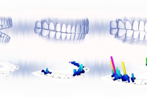Cyfrowa analiza zgryzu  w naszym gabinecie